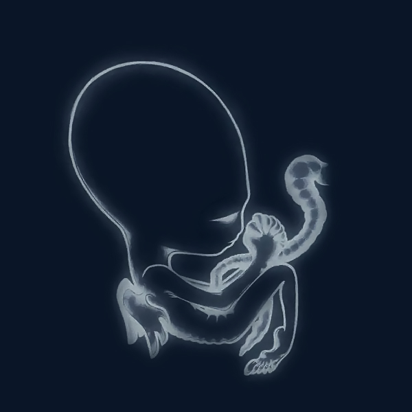 Copertina Disco Vinile 33 giri Ágætis Byrjun [2 LP + CD] di Sigur Ros